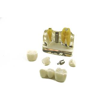 Implant ve Kpr Eitim Modeli