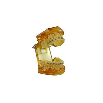 Ortodonti Metal Braket Model