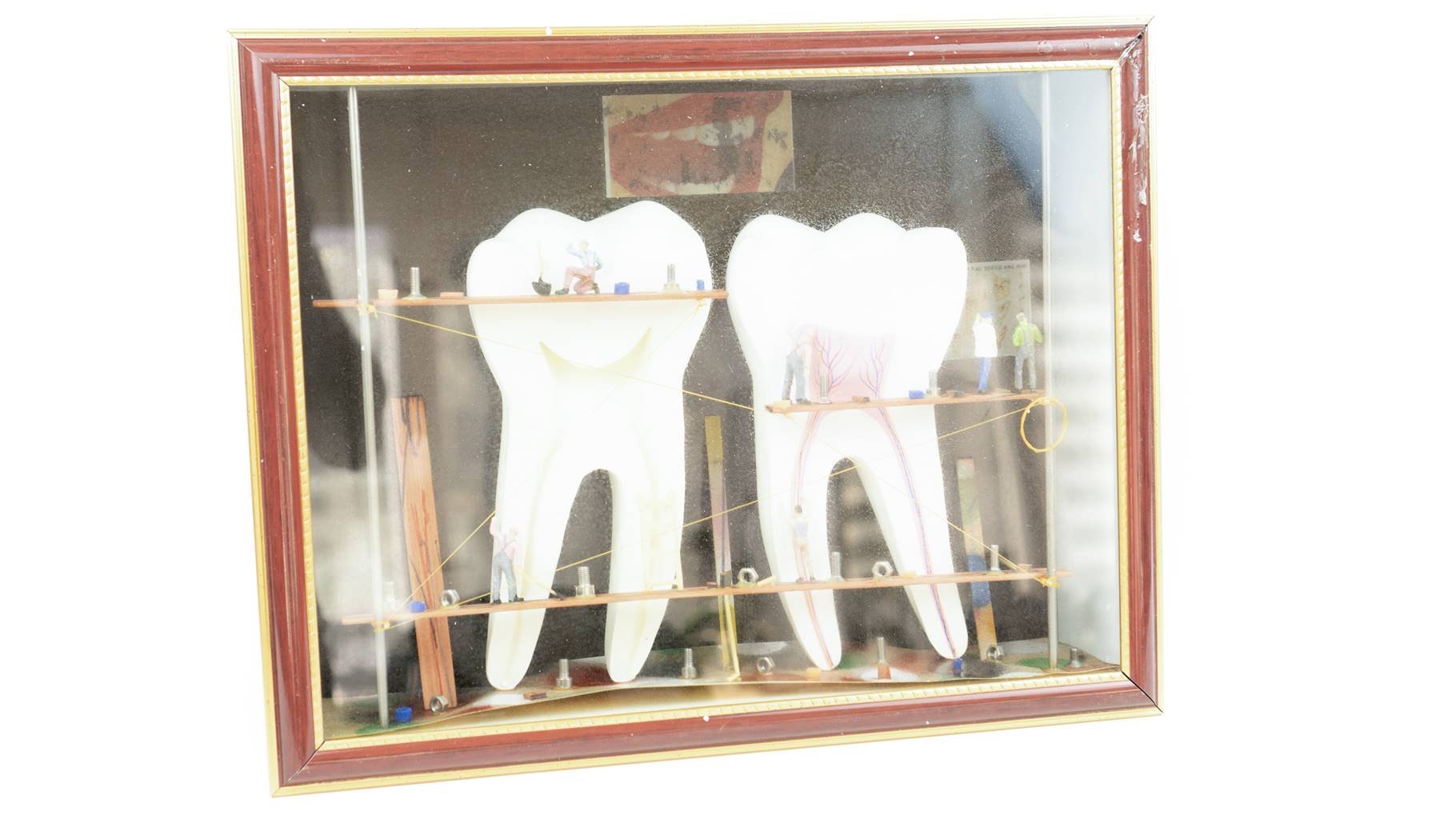 Endodonti Di Model ereve