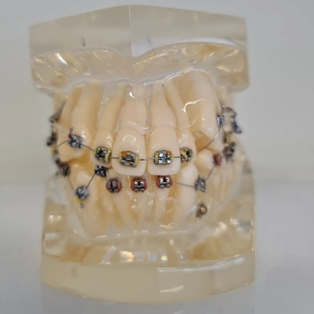 TM218 Ortodonti Hasta Eitim Modeli Metal Braket