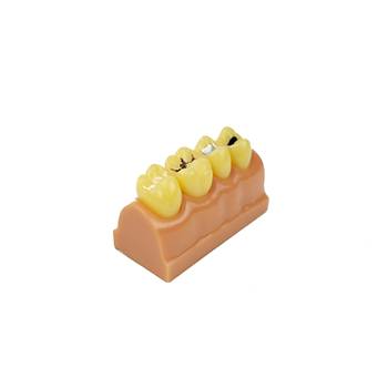 Endodonti Amalgam & Kompozit Dolgu Modeli